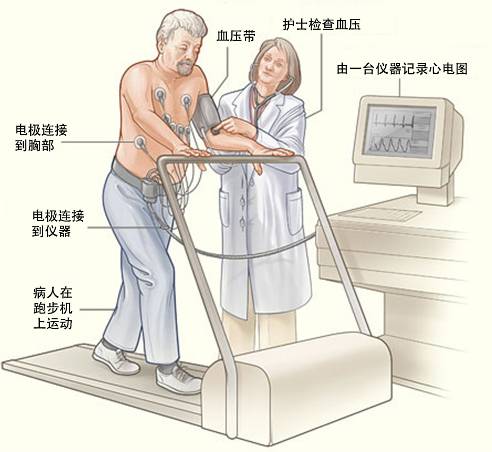 冠心病需要做哪些檢查？(圖3)